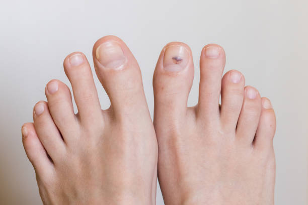 Foot Health