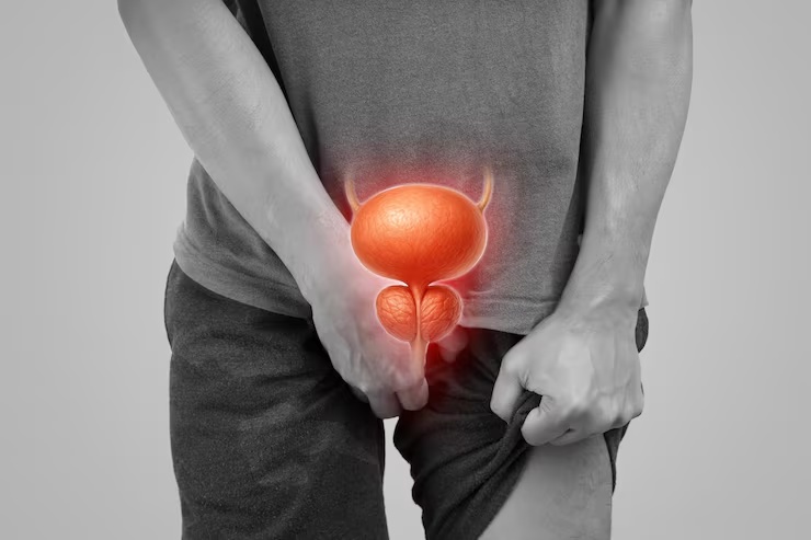 Prostate Care