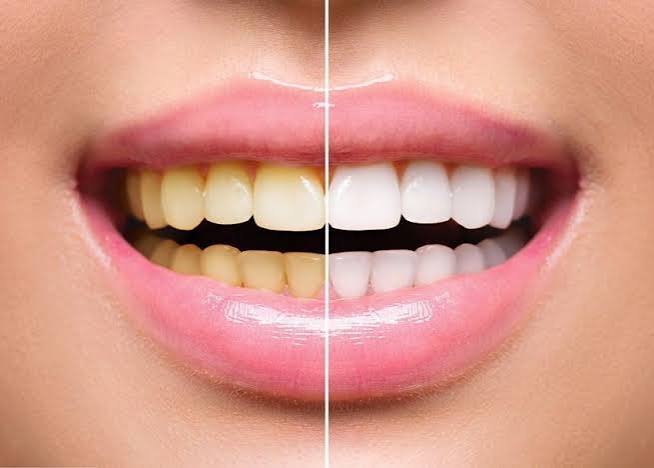 Smile Care